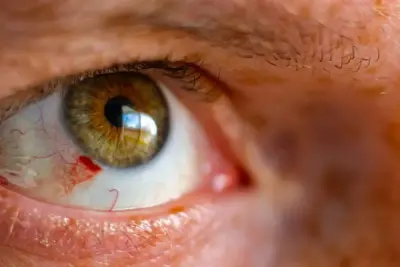 Evil Eye